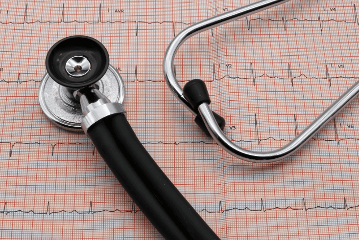 Stethoscope on top of an ECG printout with heartbeat patterns.